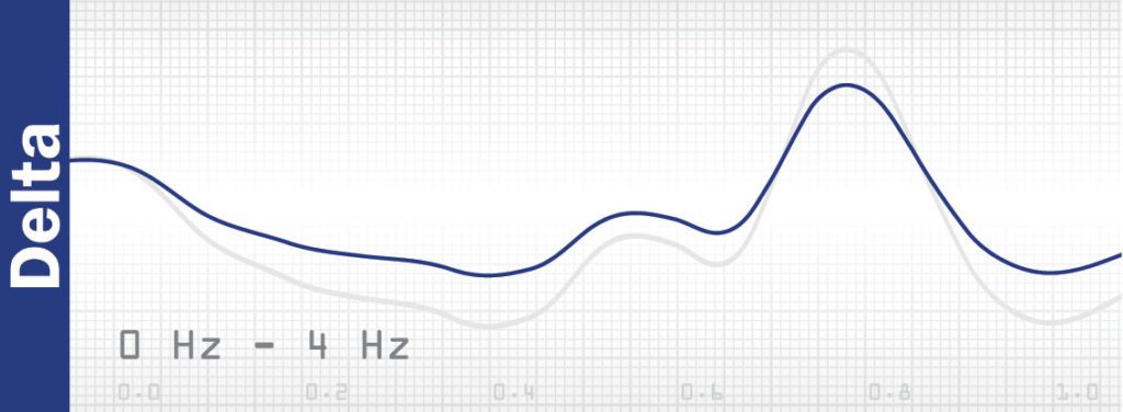 meditation and brain waves - Delta wave